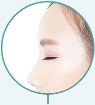 C-8 S-line Nose Surgery method image 4