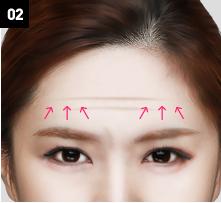 D-6 Upper-Lower forehead lifting image 2