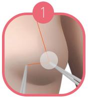 Making the Nipple and the Areola_image 1