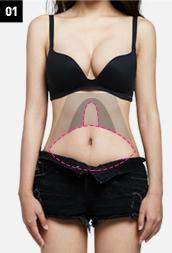 H-4 Abdomen Liposuction-Severe Drooping image 1