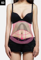 H-4 Abdomen Liposuction-Severe Drooping image 3