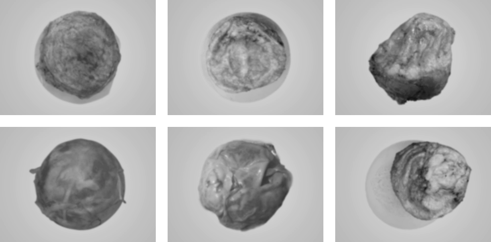 Image of real capsules removed during Korean breast revision surgery.