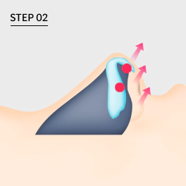 Correct long nose by correcting wing cartilage angle.