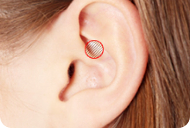 Image of ear cartilage used for tip plasty.