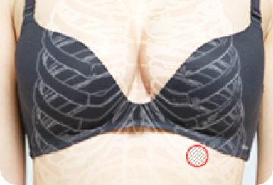 Image of costal cartilage used for tip plasty.