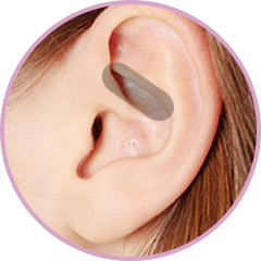 Ear cartilage for tip plasty.