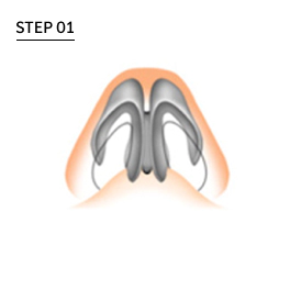 Big nose with more fat and tissue on the tip.