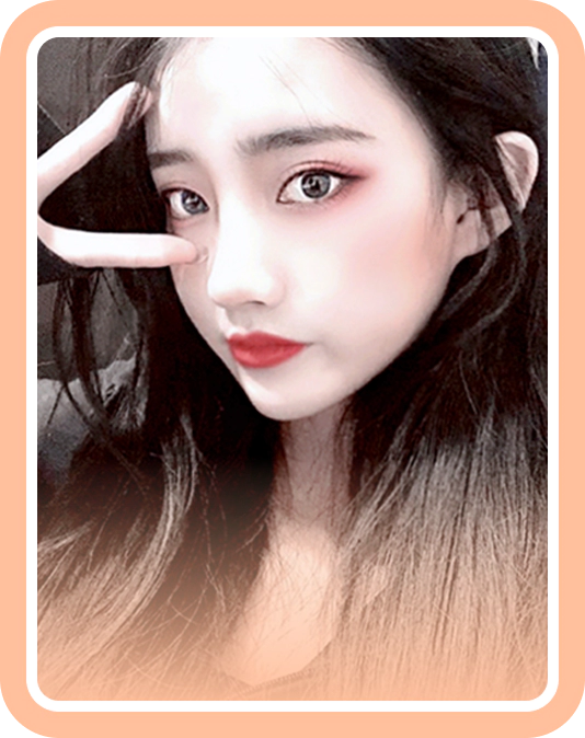 Female patient selfie after genioplasty.