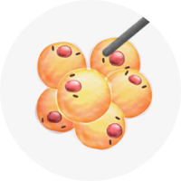 Fat balls located in the double chin.