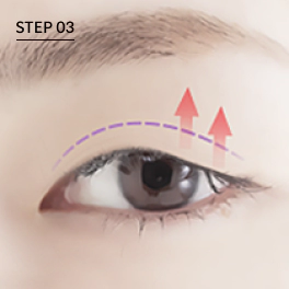 Upward direction for lifting drooping eyes.