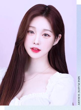 Non- incision double eyelid patient with pretty eyes.
