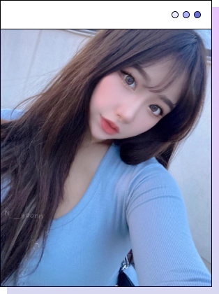 Slimmer jawline and face after double chin surgery.