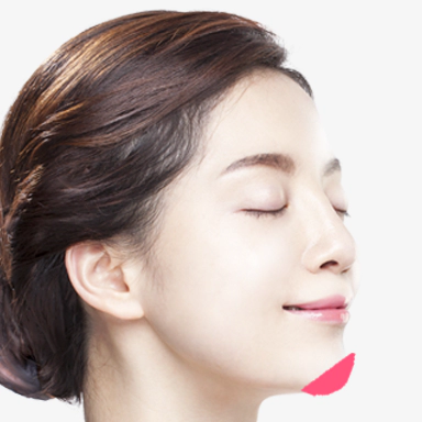 Chin implant contouring surgery.