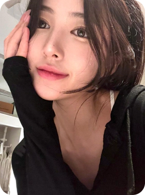 Double chin surgery patient with a slimmer jawline.