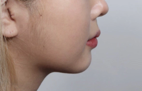 Smooth jawline.