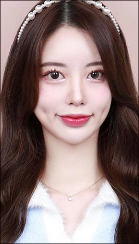 Semi out line double eyelid surgery.