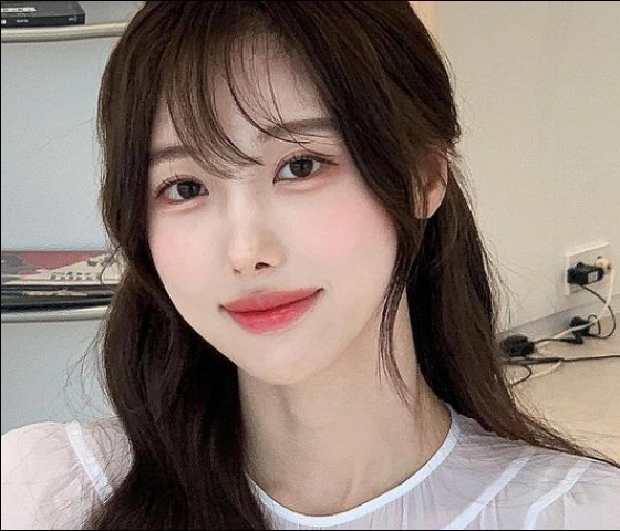 Singular canthoplasty patient.