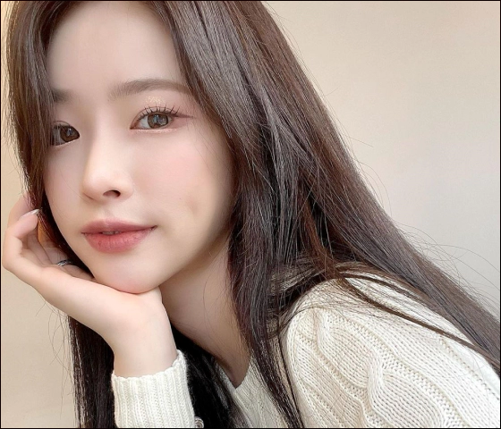 Patient who did over two types of canthoplasty.