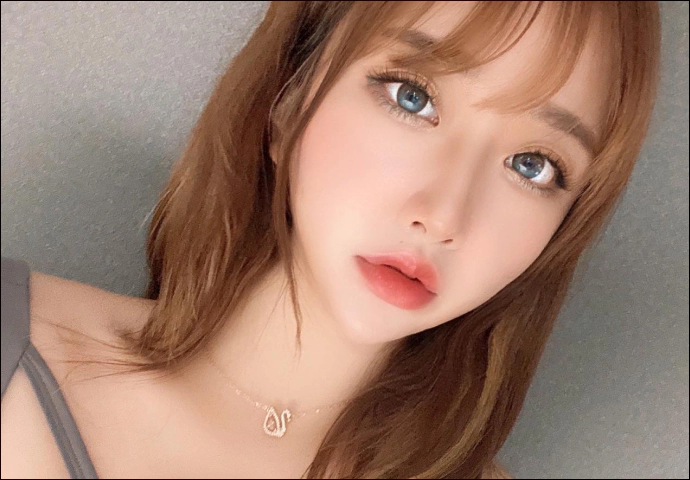 Partial incision double eyelid surgery results with ptosis correction.