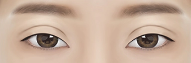 안검 하수가 있어 졸려보이는 눈.