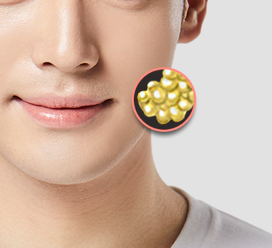 Male facial contouring buccal fat removal.