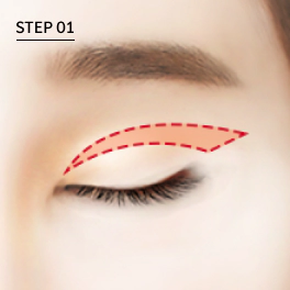 중년상안검 수술시 늘어진 피부와 지방을 필요한 만큼만 남기고 적절하게 제거.