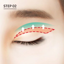 상안검 수술시 늘어진 안륜근도 함께 제거하여 근육을 제대로 당겨 고정.