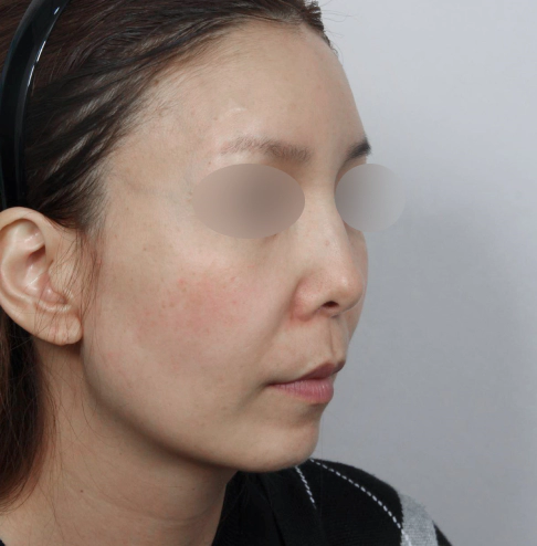 Woman visiting the dermatology clinic for facial pigmentation concerns.