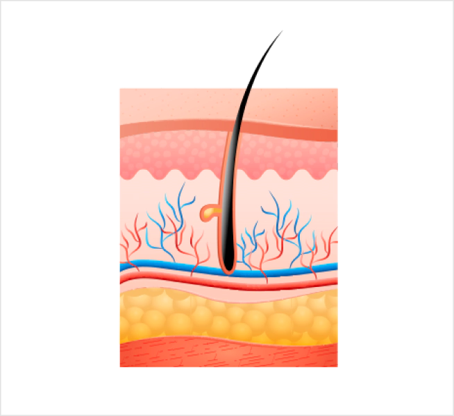 Image of skin layers for Titanium lifting 1.