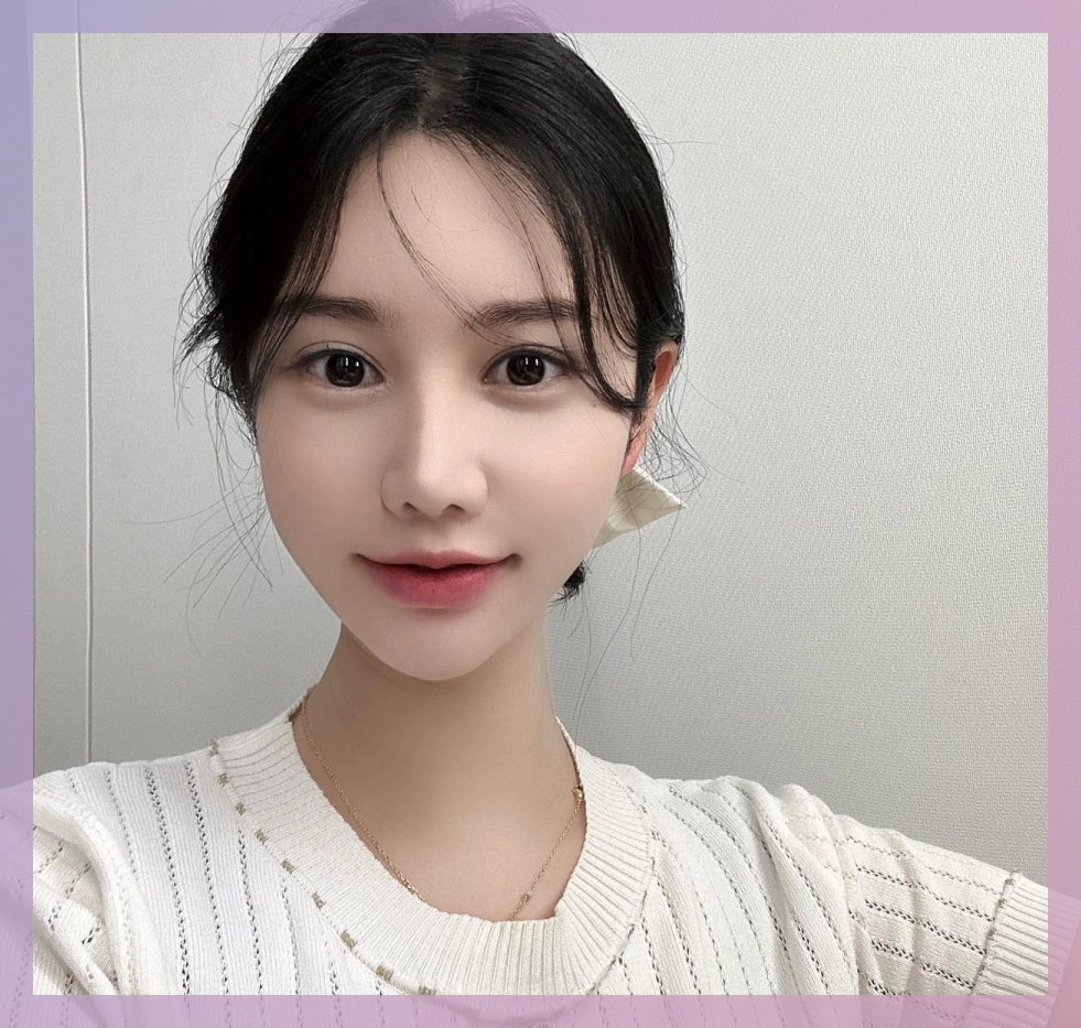 Photo of a girl smiling after acne treatment.