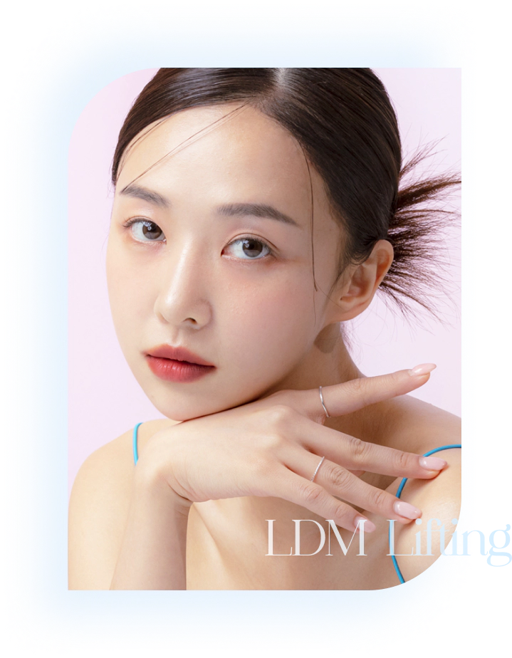 LDM lifting model.