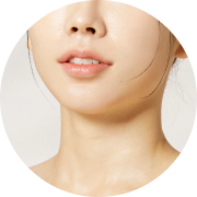 Square jaw vline injection.