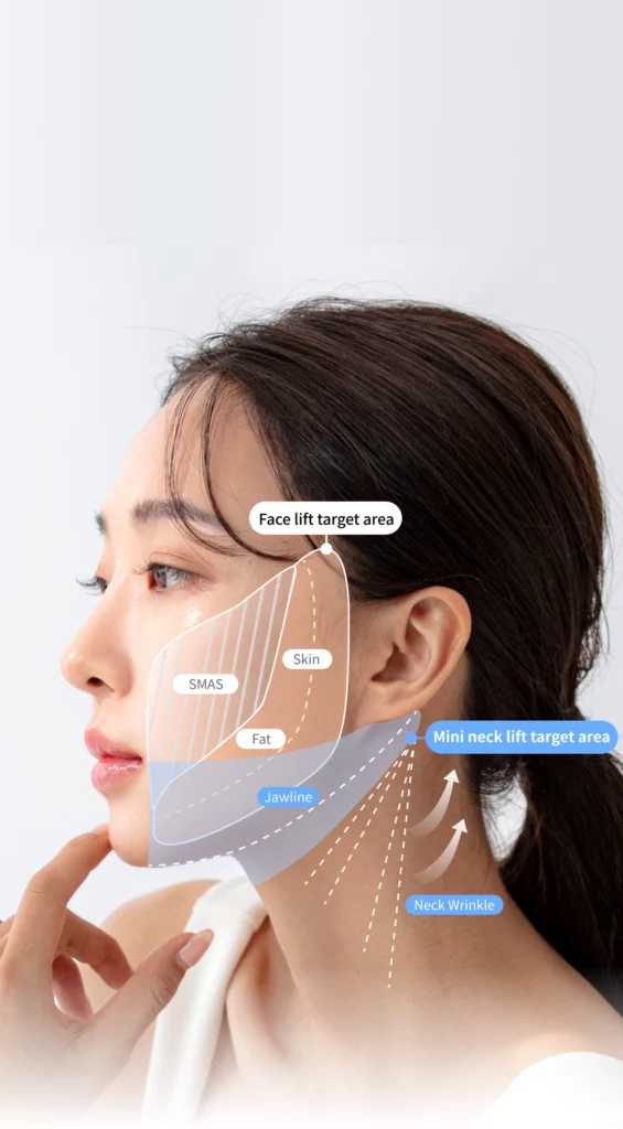 Korean facelift and Korean neck lift surgery target areas.