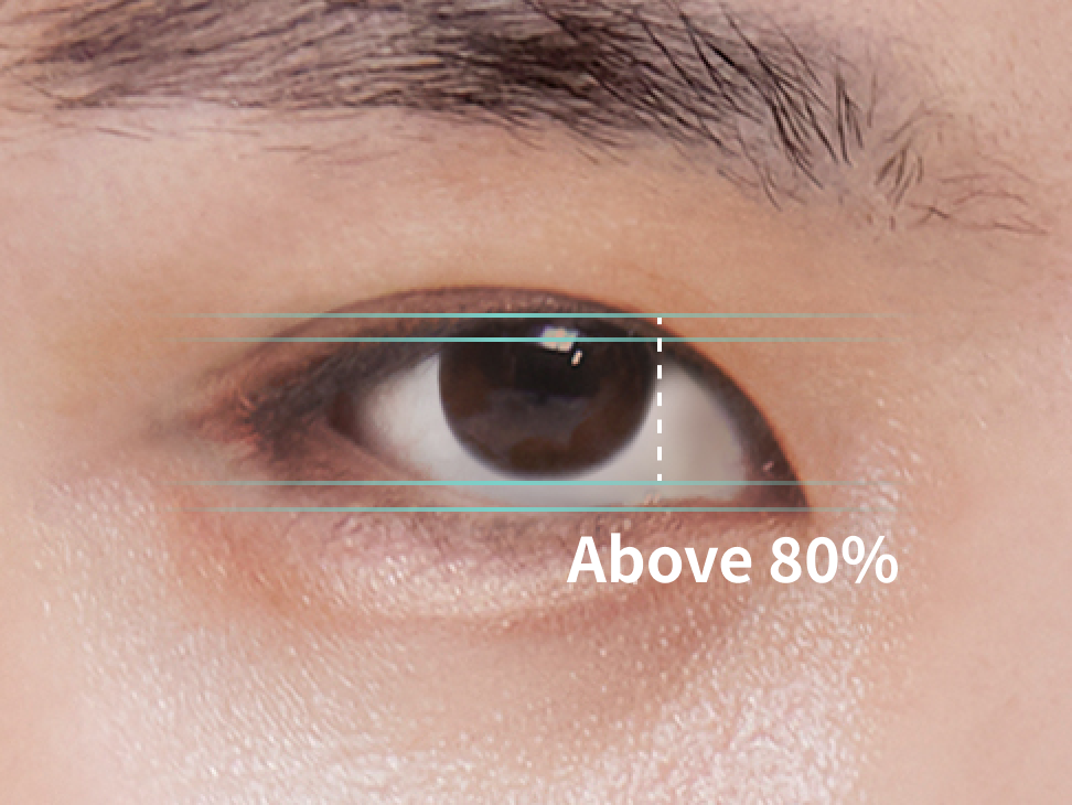 Male eyes that are normally exposed and don't need ptosis correction.