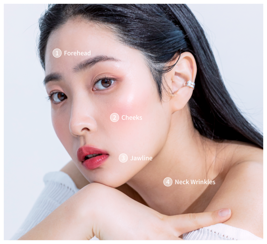 Areas where Titanium Lifting is possible.