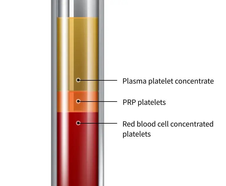 PRP procedure that helps increase survival rate forKorean fat transfer breast augmentation.