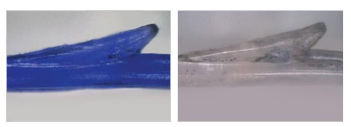 Thread lifting in Korea dissolving thread that stimulates collagen production.