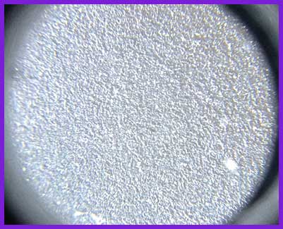 Image showing the nano surface of Motiva Breast Implants Surgery Korea.