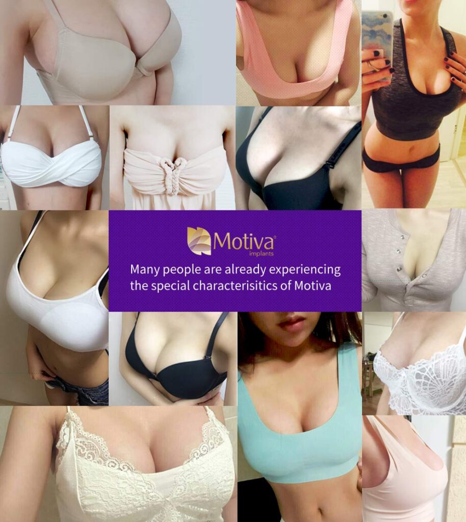 Selfie reviews for Motiva Breast Implants Surgery Korea.