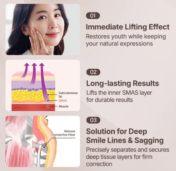 Illustration explaining the facelift method with SMAS layer lifting, showing immediate lifting effect, long-lasting structural support, and correction of deep smile lines and facial sagging.