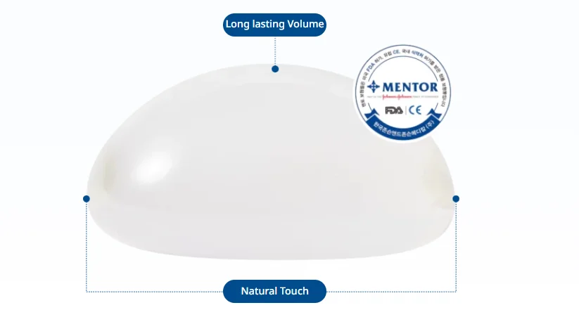 Breast fat transfer side effects comparison image highlighting implant-related considerations such as long-lasting volume and tactile differences when evaluating alternatives to fat grafting.