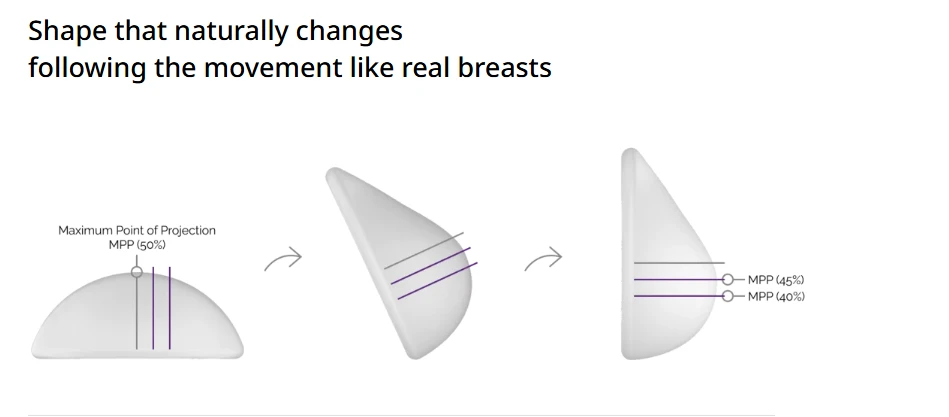 Diagram illustrating how implant shape responds to movement, explaining the bras after breast augmentation method that supports natural motion and reduces pressure during daily activities.