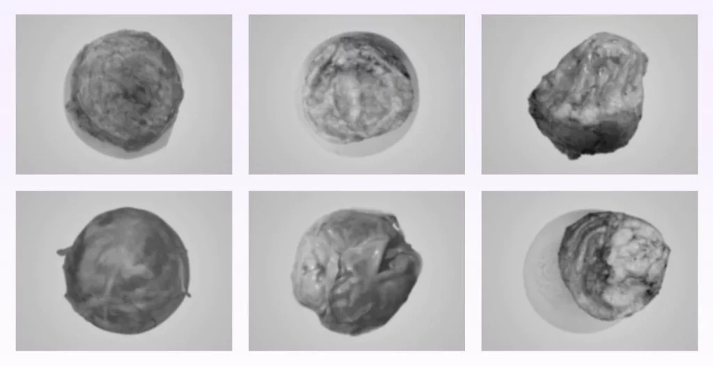 Capsules that are removed together with the implant during breast implant exchange surgery. 
