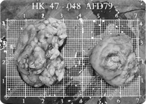 Dense and fatty saliva gland tissues laid out after salivary gland removal.