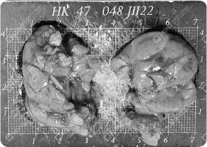Multiple sections presented for analysis following salivary gland removal.