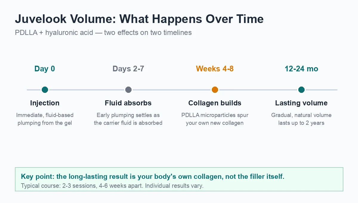 Juvelook Volume timeline infographic showing immediate hyaluronic acid volume and gradual PDLLA collagen building lasting 12 to 24 months
