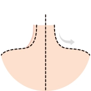 Diagram explaining trapezius botox symmetry and alignment, highlighting balanced muscle relaxation to improve neck and shoulder proportion.