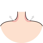 Visual depiction of post-treatment results after trapezius botox, showing softened shoulder contours and a more defined neck-to-shoulder line.