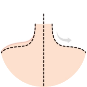 Anatomical illustration explaining trapezius botox treatment alignment, highlighting balanced muscle relaxation on both shoulders to improve neck and shoulder symmetry.