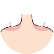 Visual guide showing the effect of trapezius botox after treatment, with softened shoulder contours and a slimmer, more refined neck-to-shoulder line.